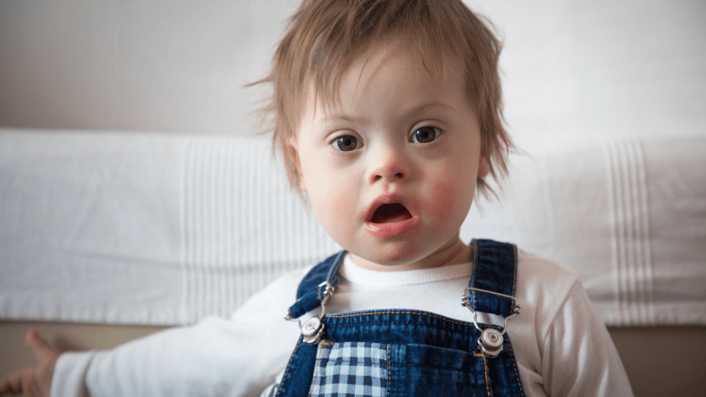 neonato sindrome di down. Assistenza babysitter Italia per bambini con sindrome di down Sitterabile